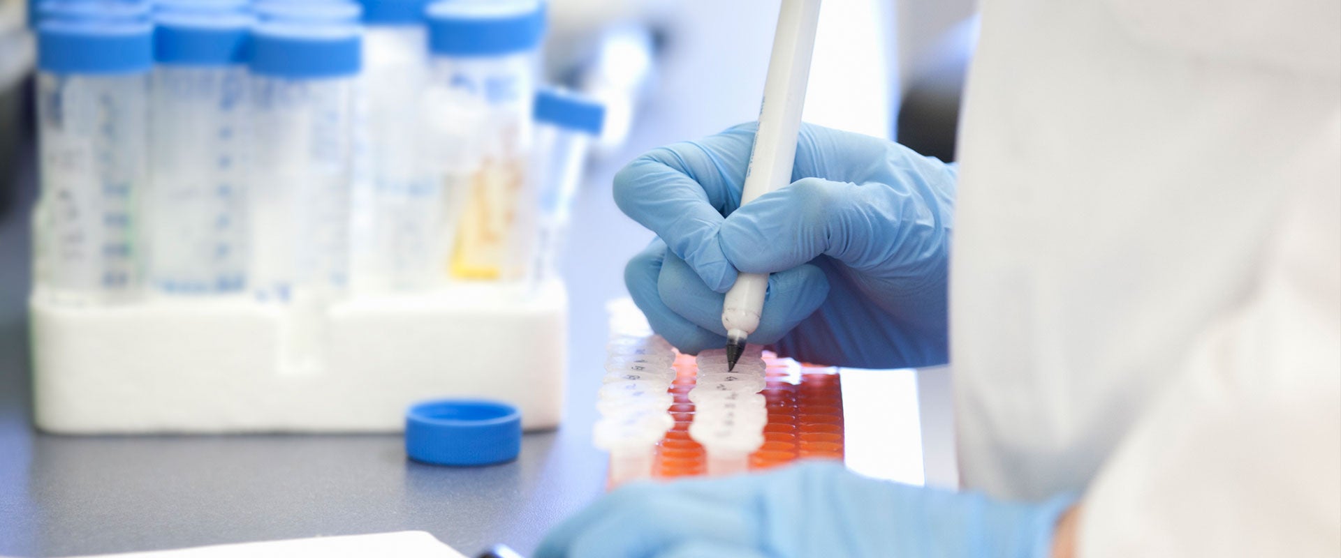 person in lab coat marking samples