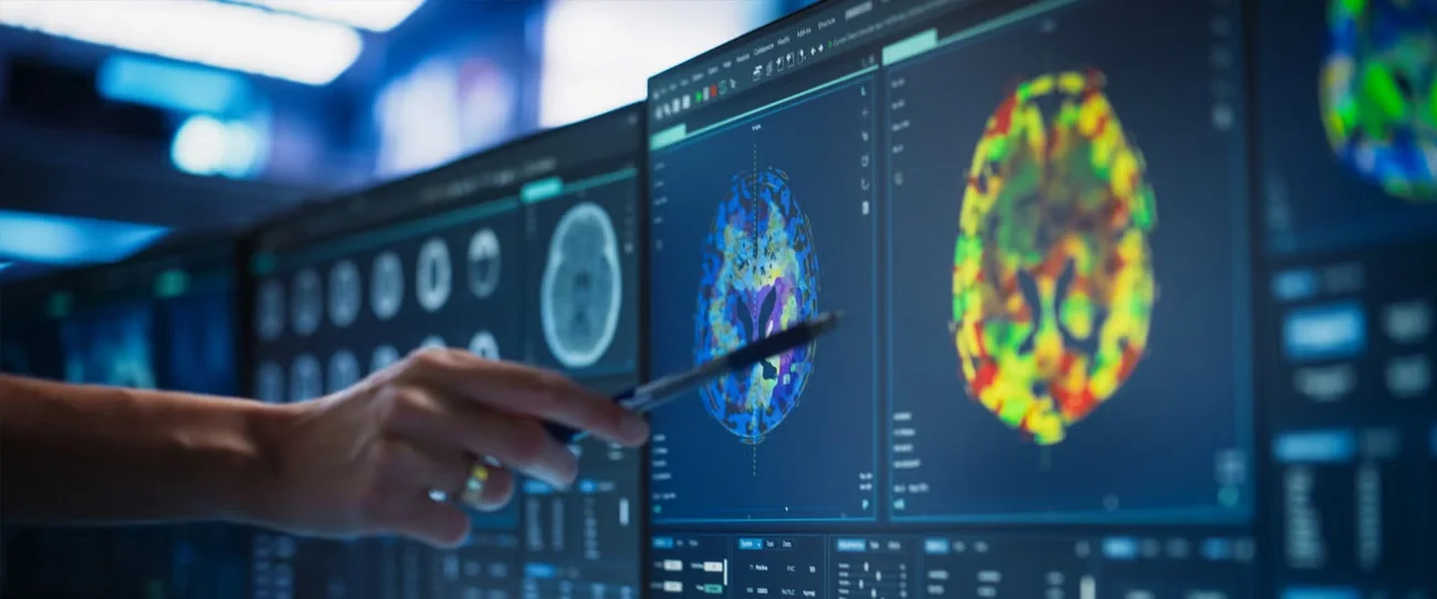 Person pointing at brain scan with pen